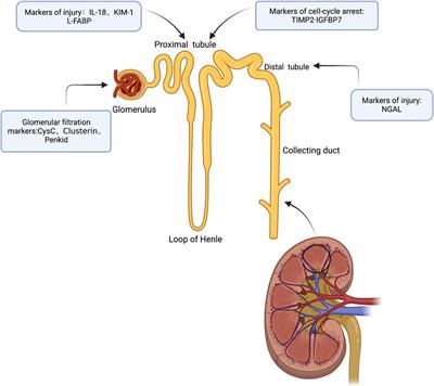 Advances in the study of subclinical AKI biomarkers